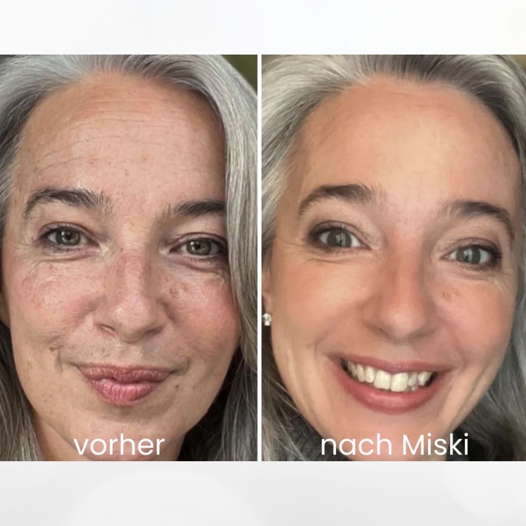 Mikro-Infusionssystem