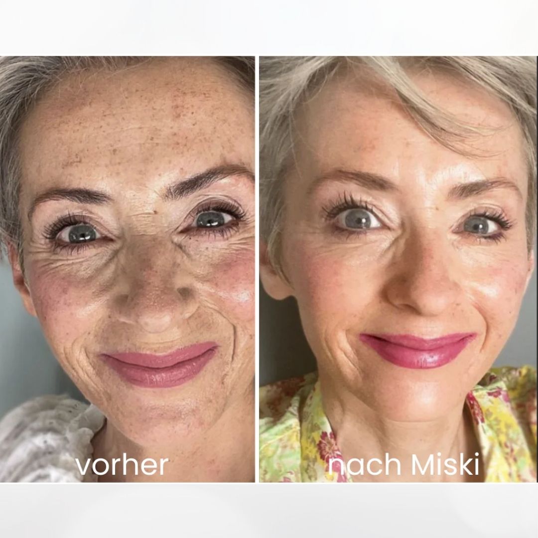 Mikro-Infusionssystem