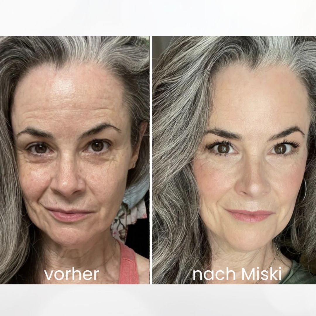 Mikro-Infusionssystem